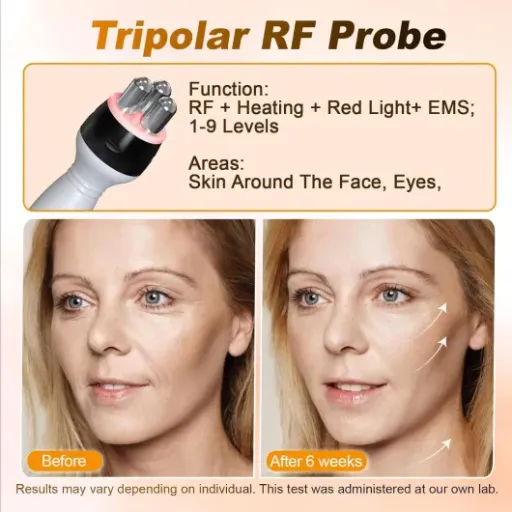 Avis Qewher Radiofréquence Visage 3 en 1 : un appareil minceur maison assez complet pour visage et corps