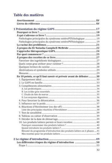 81mZgk8ogML._SL1500_