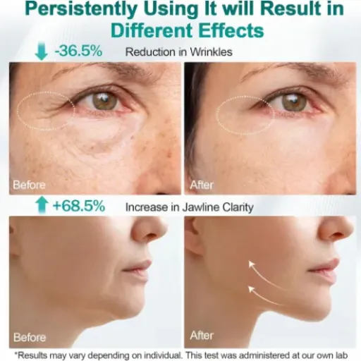 Test Radiofréquence Visage 4 EN 1 : ça fait le job mais pas de miracles