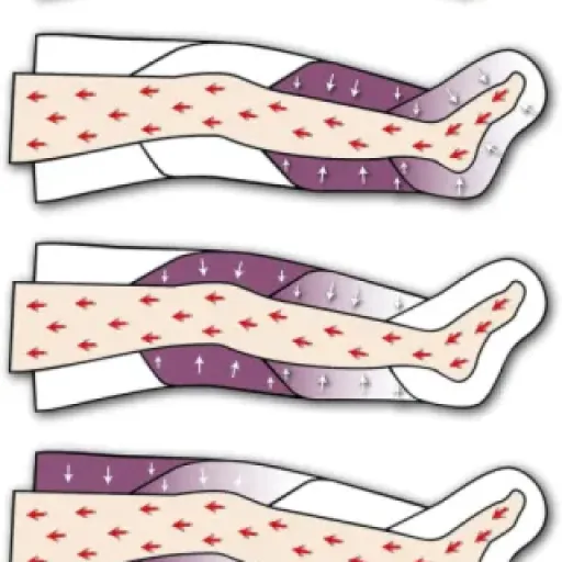 Test Pressothérapie PressoMassaggio Plus+ : ça fait le job pour se détendre à la maison.