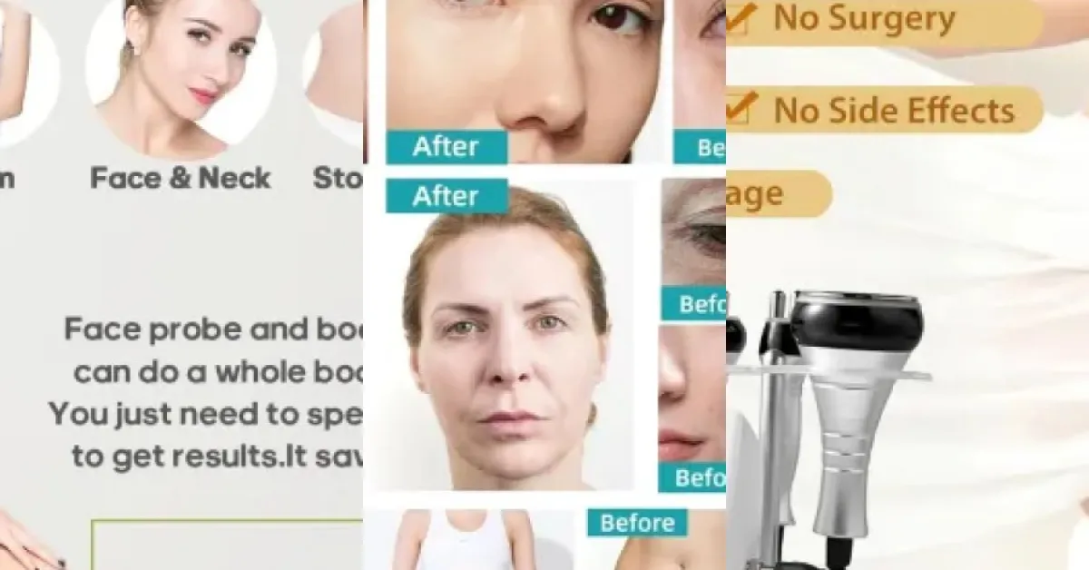 Les meilleurs machines radiofrequence anti rides visage : notre top 5 (2026)