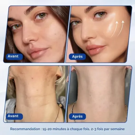 Test Qewher Cellulite 3-en-1 40K : un vrai coup de pouce anti-cellulite… si tu es prêt(e) à être régulier